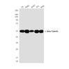 beta Tubulin Mouse Monoclonal Antibody