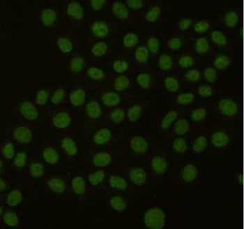PCNA (6B12) Mouse Monoclonal Antibody