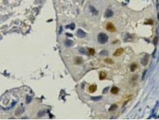 PCNA (9C9) Mouse Monoclonal Antibody