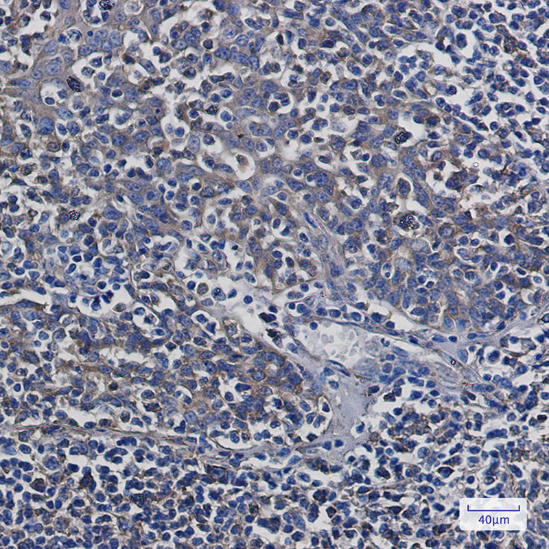 beta Tubulin Rabbit Monoclonal Antibody