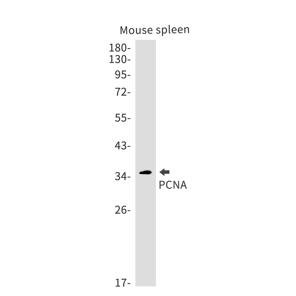 PCNA Rabbit Monoclonal Antibody