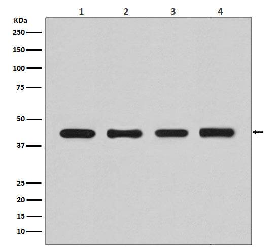 beta Actin Rabbit Polyclonal Antibody