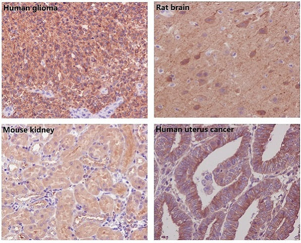 beta Tubulin Rabbit Polyclonal Antibody