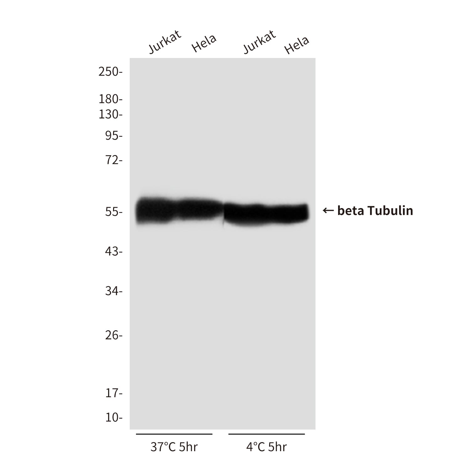 beta Tubulin (1E1) Mouse Monoclonal Antibody