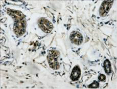 beta Tubulin (3D8) Mouse Monoclonal Antibody