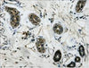 beta Tubulin (3D8) Mouse Monoclonal Antibody