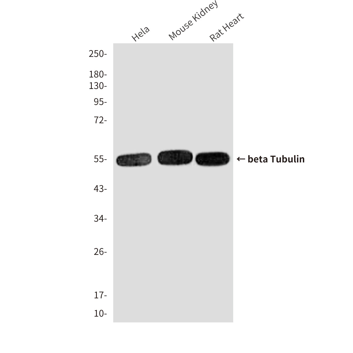 beta Tubulin (3D8) Mouse Monoclonal Antibody