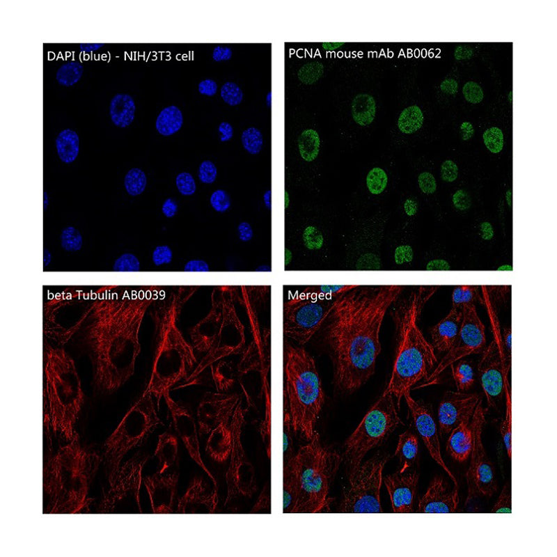 Loading Control Rabbit Polyclonal Antibody Kit