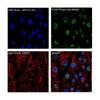 Loading Control Rabbit Polyclonal Antibody Kit