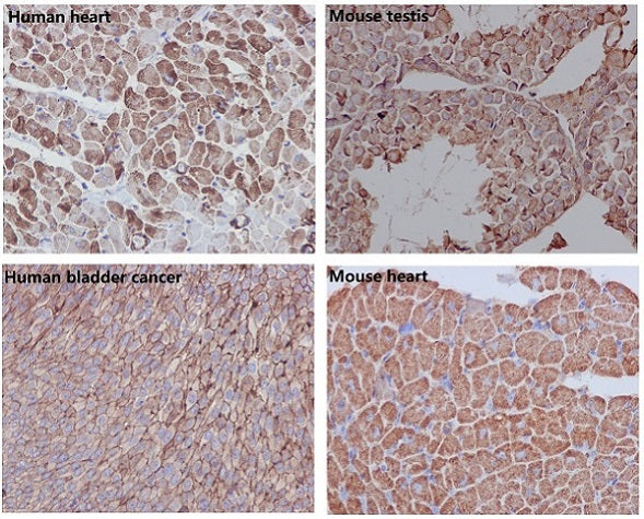 Loading Control Rabbit Polyclonal Antibody Kit