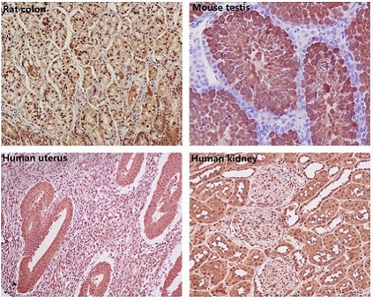 Loading Control Rabbit Polyclonal Antibody Kit