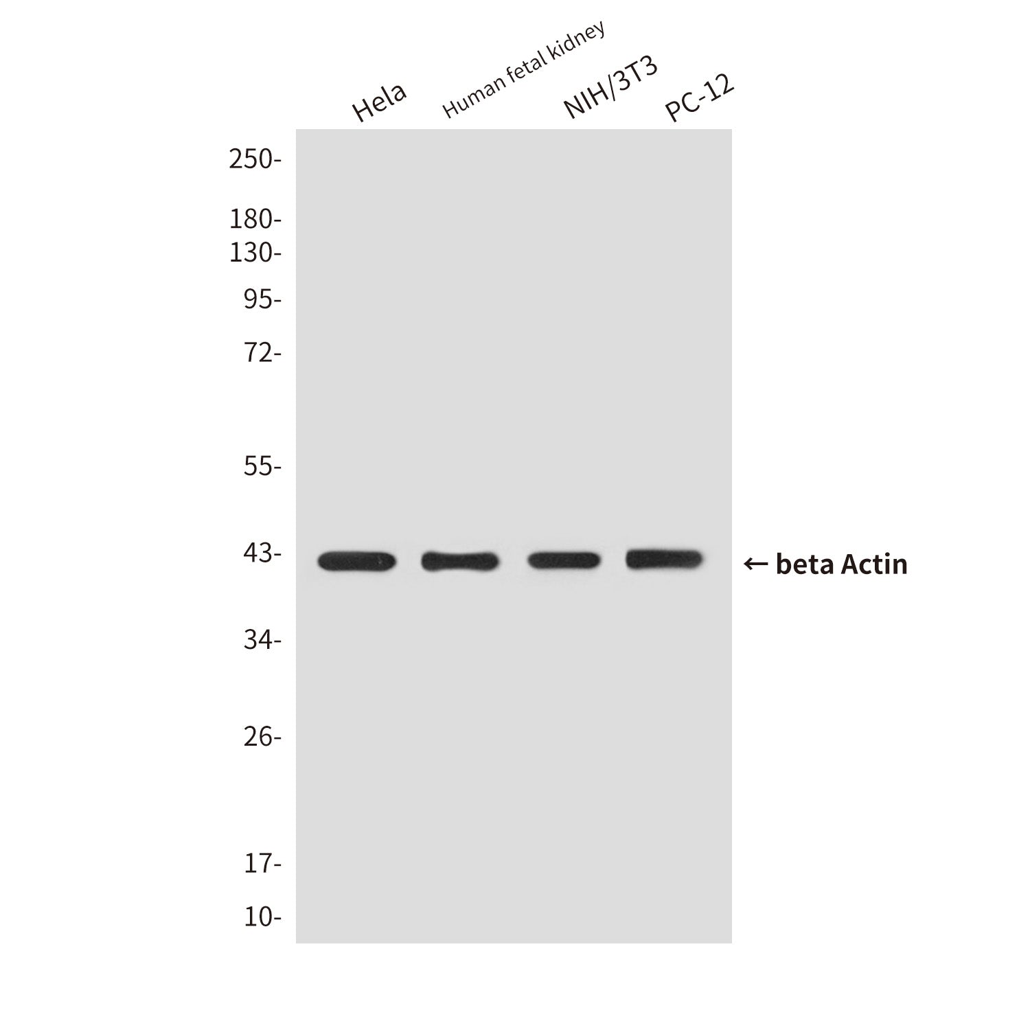 Loading Control Rabbit Polyclonal Antibody Kit