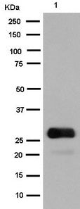 GFP Tag Rabbit Polyclonal Antibody