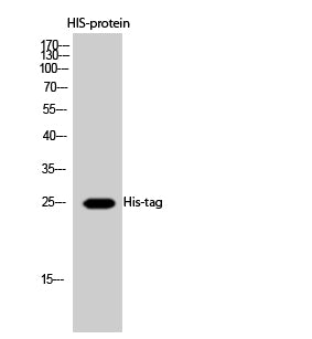 His Tag Rabbit Polyclonal Antibody