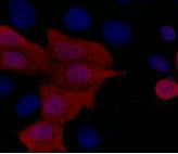 His Tag (2A2) Mouse Monoclonal Antibody