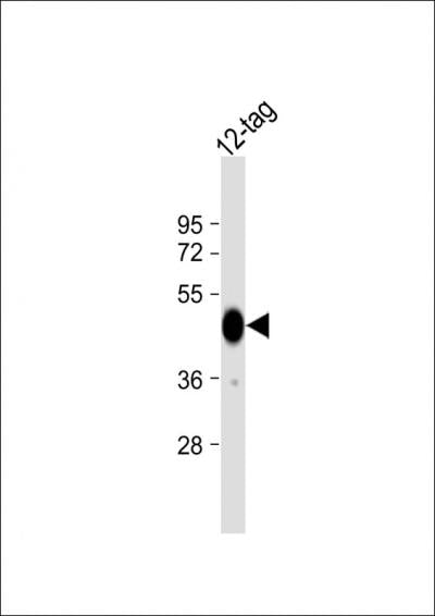 His Tag Mouse Monoclonal Antibody (HRP)
