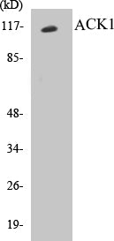 ACK1 Colorimetric Cell-Based ELISA Kit
