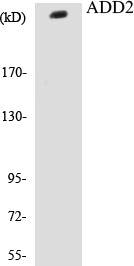 ADD2 Colorimetric Cell-Based ELISA Kit