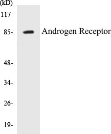 Androgen Receptor Colorimetric Cell-Based ELISA Kit