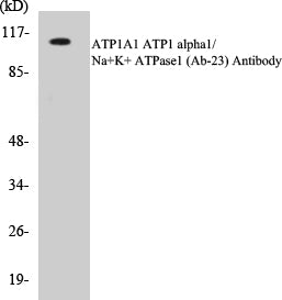 ATP1A1 Colorimetric Cell-Based ELISA Kit