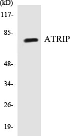 ATRIP Colorimetric Cell-Based ELISA Kit