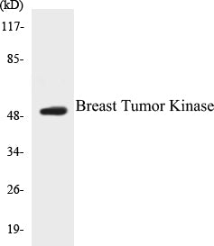 Breast Tumor Kinase Colorimetric Cell-Based ELISA Kit