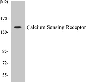 Calcium Sensing Receptor Colorimetric Cell-Based ELISA Kit