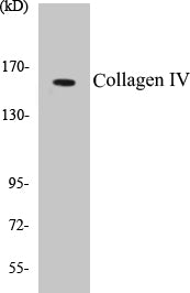 Collagen IV Colorimetric Cell-Based ELISA Kit