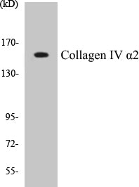 Collagen IV alpha2 Colorimetric Cell-Based ELISA Kit