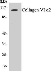 Collagen VI alpha2 Colorimetric Cell-Based ELISA Kit