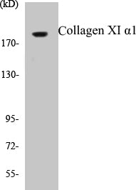 Collagen XI alpha1 Colorimetric Cell-Based ELISA Kit