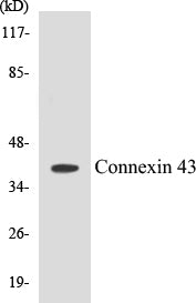 Connexin 43 Colorimetric Cell-Based ELISA Kit