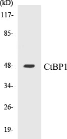 CtBP1 Colorimetric Cell-Based ELISA Kit