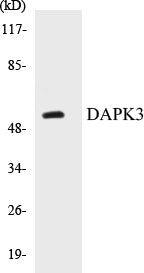 DAPK3 Colorimetric Cell-Based ELISA Kit