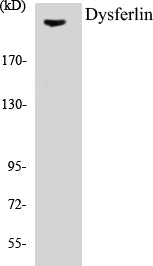 Dysferlin Colorimetric Cell-Based ELISA Kit