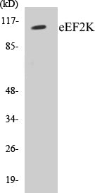 eEF2K Colorimetric Cell-Based ELISA Kit