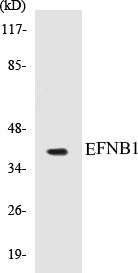 EFNB1 Colorimetric Cell-Based ELISA Kit