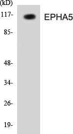 EPHA5 Colorimetric Cell-Based ELISA Kit