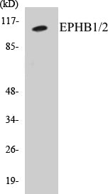 EPHB1/2 Colorimetric Cell-Based ELISA Kit