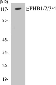 EPHB1/2/3/4 Colorimetric Cell-Based ELISA Kit