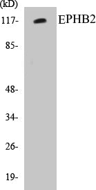 EPHB2 Colorimetric Cell-Based ELISA Kit