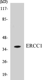 ERCC1 Colorimetric Cell-Based ELISA Kit