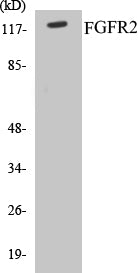 FGFR2 Colorimetric Cell-Based ELISA Kit