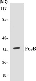 FosB Colorimetric Cell-Based ELISA Kit