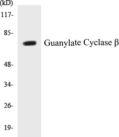 Guanylate Cyclase beta Colorimetric Cell-Based ELISA Kit