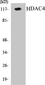 HDAC4 Colorimetric Cell-Based ELISA Kit