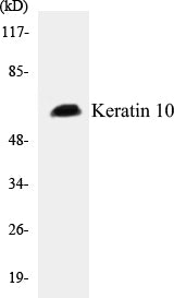 Keratin 10 Colorimetric Cell-Based ELISA Kit