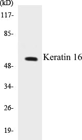 Keratin 16 Colorimetric Cell-Based ELISA Kit