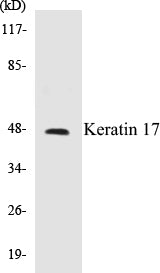 Keratin 17 Colorimetric Cell-Based ELISA Kit