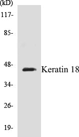 Keratin 18 Colorimetric Cell-Based ELISA Kit